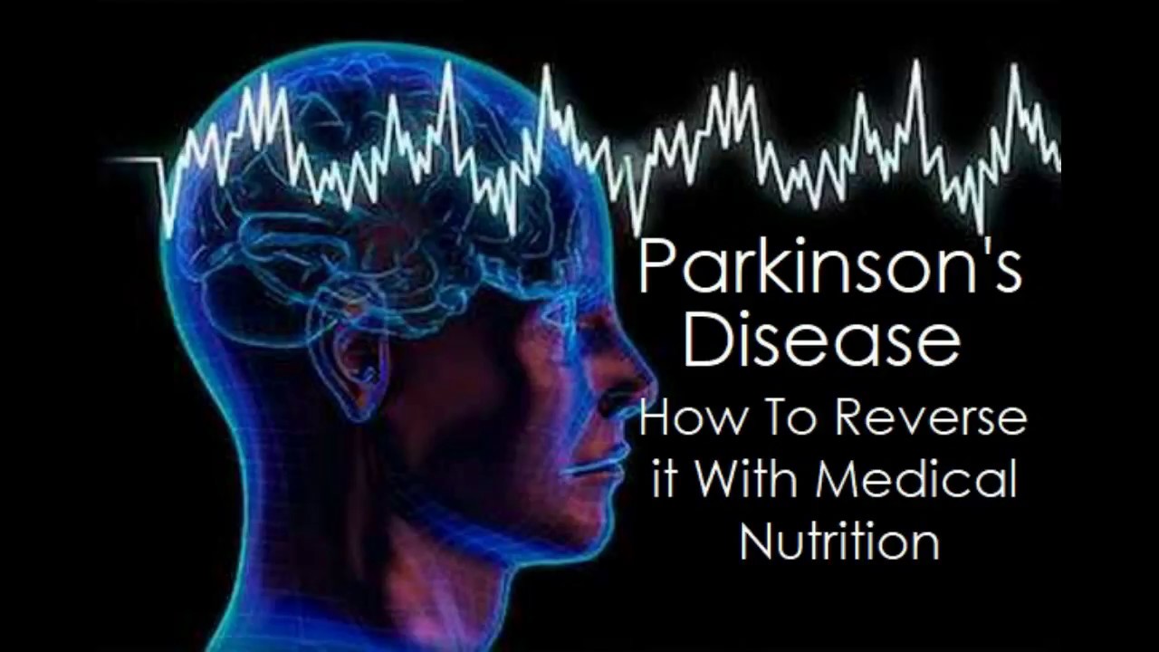 Dr. Wallach On How To Treat Parkinsons 1